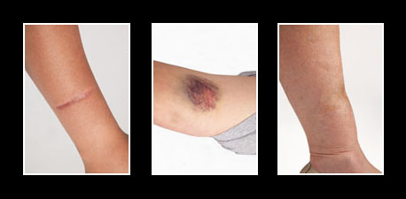 Personal & criminal injury photographs